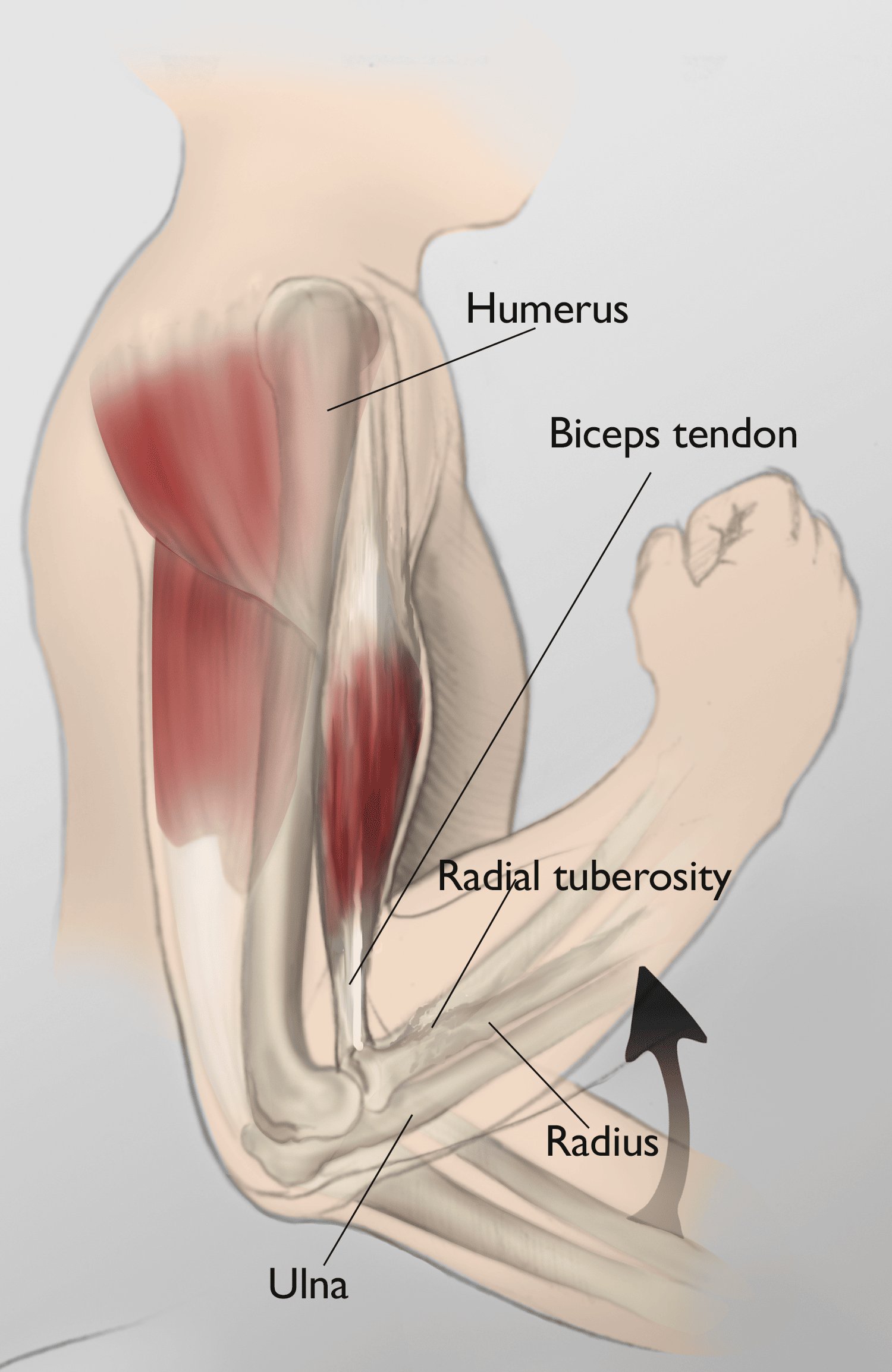 when-is-it-too-late-to-repair-a-torn-bicep-tendon_1725275942