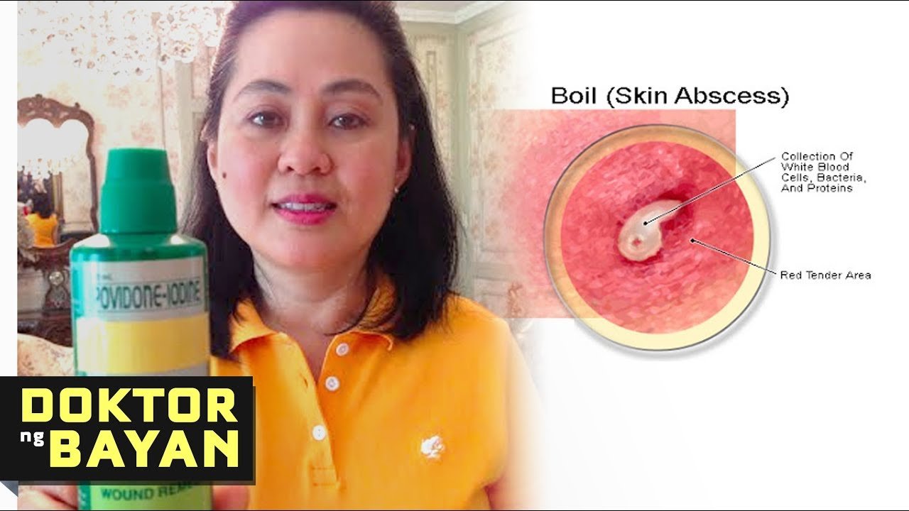 gamot-sa-pigsa-sa-kilikili_1746913368